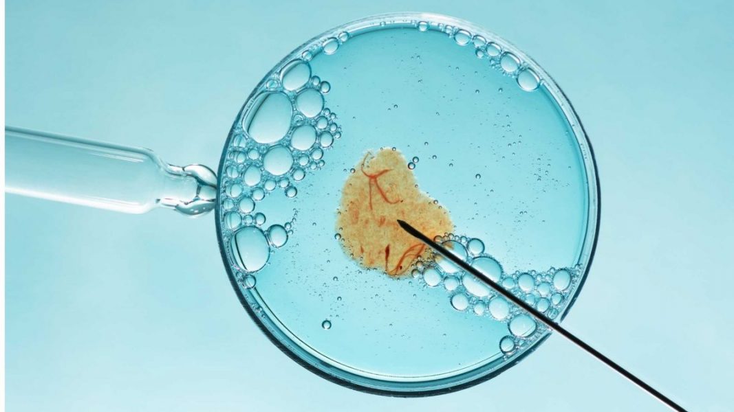 que es la fecundación in vitro